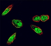 Confocal immunofluorescent analysis of c-Src antibody with A375 cells followed by Alexa Fluor 488-conjugated goat anti-rabbit lgG (green). Actin filaments have been labeled with Alexa Fluor 555 Phalloidin (red).