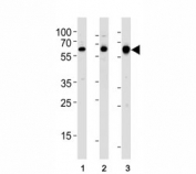 Western blot analysis of lysate from (1) human MCF-7, (2) rat PC-12, and (3) mouse C2C12 cell line using c-Src antibody at 1:1000.