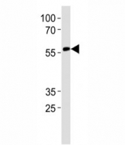 RUNX2 antibody western blot analysis in CEM lysate. Predicted molecular weight: 50-60 kDa.