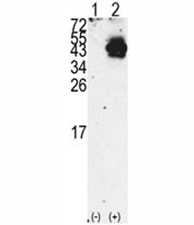Western blot analysis of PDX1 antibody and 293 cell lysate either nontransfected (Lane 1) or transiently transfected with the PDX1 gene (2).~