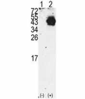 Western blot analysis of PDX1 antibody and 293 cell lysate either nontransfected (Lane 1) or transiently transfected with the PDX1 gene (2). Observed molecular weight 31/40~46kDa (unmodified/modified).