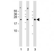 Western blot analysis of 1) human HepG2, 2) mouse testis and 3) rat lung tissue lysate with NRAS antibody. Predicted molecular weight ~21 kDa.