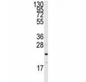 Western blot analysis of NRAS antibody and CEM lysate. Predicted molecular weight ~21 kDa.