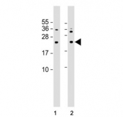 Western blot analysis of human 1) A431 and 2) HepG2 cell lysate with NRAS antibody. Predicted molecular weight ~21 kDa.