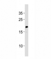 NRAS antibody western blot analysis in MCF-7 lysate. Predicted molecular weight ~21 kDa.