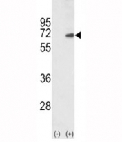 Western blot analysis of SMAD4 antibody and 293 cell lysate (2 ug/lane) either nontransfected (Lane 1) or transiently transfected with the human gene (2). Predicted molecular weight: 60-70 kDa.