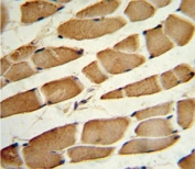 IHC analysis of FFPE human skeletal muscle stained with SMAD4 antibody
