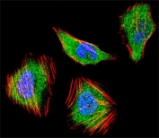 Fluorescent confocal image of HeLa cell stained with SMAD4 antibody at 1:25. SMAD4 immunoreactivity is localized to the cytoplasm and nucleus.
