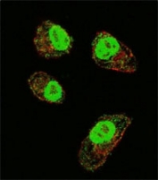 Confocal immunofluorescent analysis of HIF1A antibody with MDA-MB231 cells followed by Alexa Fluor 488-conjugated goat anti-rabbit lgG (green). Actin filaments have been labeled with Alexa Fluor 555 Phalloidin (red).