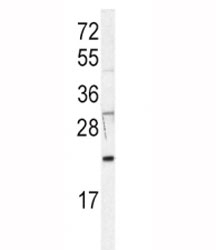 Western blot analysis of HRAS antibody in Jurkat lysate. Predicted molecular weight ~21 kDa.