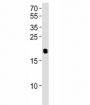 Western blot analysis of lysate from 293T cell line using HRAS antibody diluted at 1:1000. Predicted molecular weight ~21 kDa.