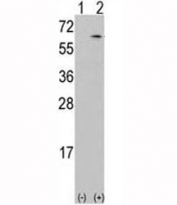 Western blot analysis of CAMKK antibody and 293 cell lysate either nontransfected (Lane 1) or transiently transfected with the CAMKK1 gene (2).