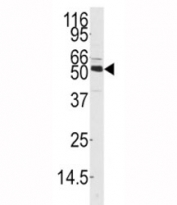 Western blot analysis of CAMKK1 antibody and mouse thymus tissue lysate. Predicted molecular weight 55-60 kDa.