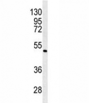Western blot analysis of ANGPTL6 antibody and K562 lysate.