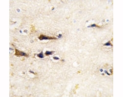 IHC analysis of FFPE human brain tissue stained with BACE1 antibody~