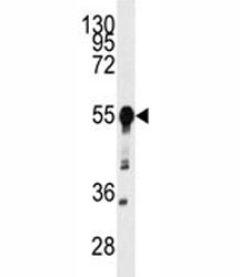 Western blot analysis of BACE1 antibody and mouse heart tissue lysate.