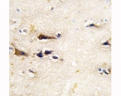 IHC analysis of FFPE human brain tissue stained with BACE1 antibody