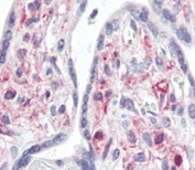 IHC analysis of FFPE human placenta tissue stained with IRAK antibody