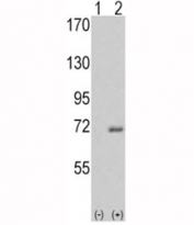 Western blot analysis of IRAK antibody and 293 cell lysate either nontransfected (Lane 1) or transiently transfected with the IRAK1 gene (2). Predicted molecular weight 68-76 kDa.