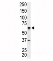 Western blot analysis of IRAK2 antibody and Jurkat cell lysate