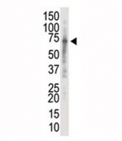 Western blot analysis of IRAK2 antibody and K562 cell lysate.