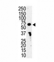 Western blot analysis of IRAK3 antibody and HL-60 cell lysate. Predicted molecular weight: ~68 kDa.