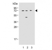 Western blot analysis 1) human Raji, 2) human K562 and 3) mouse spleen lysate with IRAK3 antibody. Predicted molecular weight: ~68 kDa.