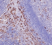 IHC staining of FFPE human tonsil with IRAK3 antibody. HIER: boil tissue sections in pH6, 10mM citrate buffer, for 20 min and allow to cool before testing.