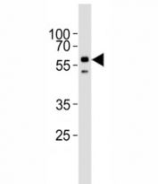 Western blot analysis of lysate from HepG2 cell line using ALK2 antibody