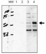 Western blot testing of human chondrocytes (C28/I2 cells), transfected with empty vector (lane 1, 3) or ALK1 (2, 4); ALK1 antibody used at 1:1000, blocking solution is 5% milk in TBST (lane 1 and 2), and 5% BSA in TBST (3 and 4). Data courtesy of Kenneth Finnson, Montreal General Hospital.