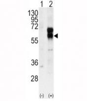Western blot analysis of ALK1 antibody and 293 cell lysate (2 ug/lane) either nontransfected (Lane 1) or transiently transfected with the ACVRL1 gene (2).