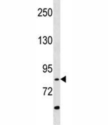 RIPK4 antibody western blot analysis in A549 lysate~