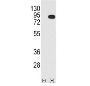 Western blot analysis B-RAF antibody and 293 cell lysate (2 ug/lane) either nontransfected (Lane 1) or transiently transfected with the BRAF gene (2). Predicted size 85-95 kDa~