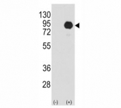 Western blot analysis of BRAF antibody and 293 cell lysate (2 ug/lane) either nontransfected (Lane 1) or transiently transfected with the B-RAF gene (2). Predicted size 85-95 kDa