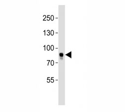 Western blot analysis of lysate from MCF-7 cell line using BRAF antibody. Predicted size 85-95 kDa~