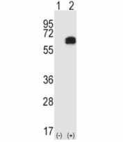 Western blot analysis of RIPK2 antibody and 293 cell lysate either nontransfected (Lane 1) or transiently transfected (2) with the RIPK2 gene.