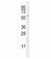 Western blot analysis of RIPK2 antibody in Ramos lysate