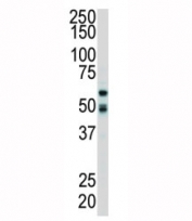 Western blot analysis of RIPK2 antibody and mouse cerebellum tissue lysate. Predicted molecular weight: 61/45 kDa (isoforms 1/2).