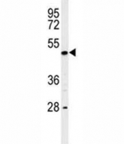 Western blot analysis of RIPK3 antibody and K562 lysate. Predicted molecular weight ~57 kDa.