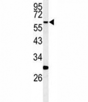 Western blot analysis of RIPK3 antibody and mouse cerebellum tissue lysate