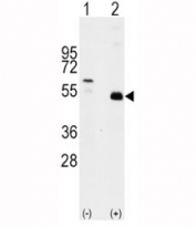 Western blot analysis of TRAF2 antibody and 293 cell lysate (2 ug/lane) either nontransfected (c) or transiently transfected with the TRAF2 gene (2). Predicted molecular weight: ~55kDa.