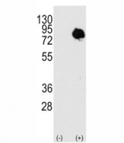 Western blot analysis of TG2 antibody and 293 cell lysate (2 ug/lane) either nontransfected or transiently transfected with the TGM2 gene. Predicted molecular weight: ~78kDa.