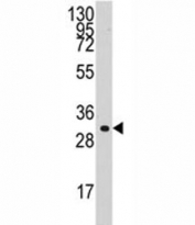 Western blot analysis of Cyclin C antibody and HL-60 lysate. Predicted molecular weight: 33-37 kDa