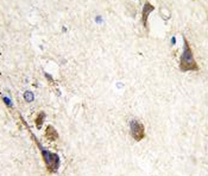 IHC analysis of FFPE human brain tissue stained with Acetylcholinesterase antibody