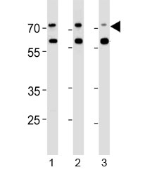 Acetylcholinesterase antibody western blot analysis in human 1) Jurkat, 2) Raji and 3) Y79 lysate. Predicted molecular weight ~68 kDa with a possible ~58 kDa isoform.