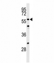 Western blot analysis of CDC25C antibody and NIH3T3 lysate. Expected molecular weight: ~53/60 kDa (unmodified/phosphorylated).