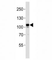 MER antibody western blot analysis in Jurkat lysate. Predicted molecular weight: 110~205 kDa depending on glycosylation level.