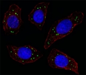 Fluorescent image of U251 cell stained with MERTK antibody at 1:25. MERTK immunoreactivity is localized to vesicles.