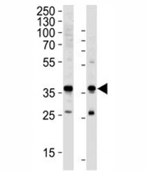 Western blot analysis of lysate from HeLa, HUVEC cell line (left to right) using anti-GAPDH antibody diluted at 1:1000 for each lane.