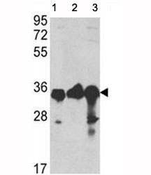Western blot analysis of anti-GAPDH antibody and 1) A2058, 2) A375, and 3) CEM lysate
